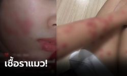 สาวโพสต์คลิป เป็นแผลรอยแดงทั่วตัว "หมอแล็บฯ" ชี้อาจเกิดจาก "เชื้อราแมว"