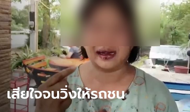 สาวสุดช้ำ ถูกอดีตสามีทำร้าย ให้เพื่อนล็อกตัว-ต่อยจนฟันหักปากฉีก แค่ขอไปนอนค้างคืนด้วย