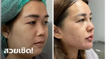 คลินิกความงามอัปเดตความสวย "จอย" เมียหลวงบุกงานแต่ง โมร่างชุดใหญ่ไฟกระพริบ