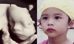 "มิว นิษฐา" โชว์ภาพอัลตร้าซาวด์ลูกในท้อง 7 เดือน เทียบความเหมือนแม่ลูก