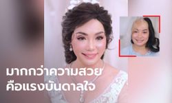 สุดยอด! ช่างแต่งหน้าแปลงโฉมเจ้าสาวที่เคยประสบอุบัติเหตุไฟคลอก สวยจนต้องปรบมือให้ (คลิป)