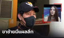 "ไทด์ เอกพันธ์" เผย ขาซ้าย "แตงโม" มีแผลลึกจนเห็นกระดูก คล้ายถูกของมีคมบาด