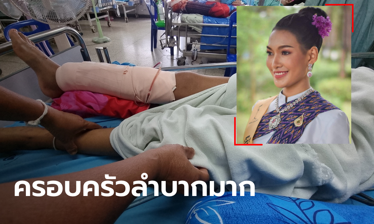 แม่น้องอาร์กี้ มิสแกรนด์หนองคาย วอนช่วยหลังรถชนสาหัส เงินติดตัวมีไม่ถึงร้อย