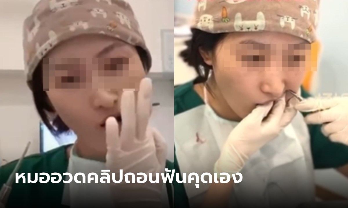 หมอฟันโพสต์คลิป "ถอนฟันคุดเอง" หวังเพิ่มความกล้าให้คนไข้ ชาวเน็ตบอกน่าสยองกว่าเดิม