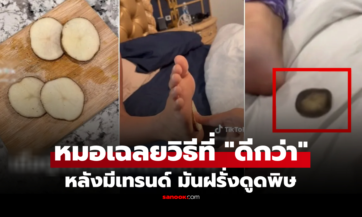 เทรนด์สุขภาพ "มันฝรั่งดูดสารพิษ" คอนเฟิร์มได้ผลสุดจึ้ง หมอไม่อยู่เฉย เฉลยวิธีที่ดีกว่านั้น!
