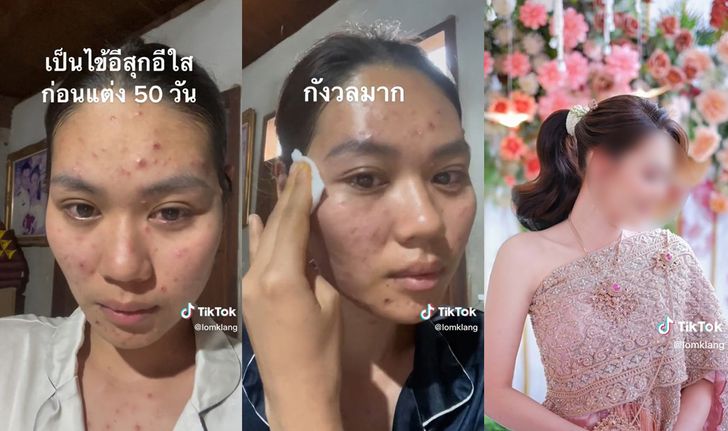 รีวิวเป็นอีสุกอีใสก่อนแต่ง เจ้าสาวสู้จนผ่านมาได้ บวกมีช่างแต่งหน้าเนรมิตความสวย