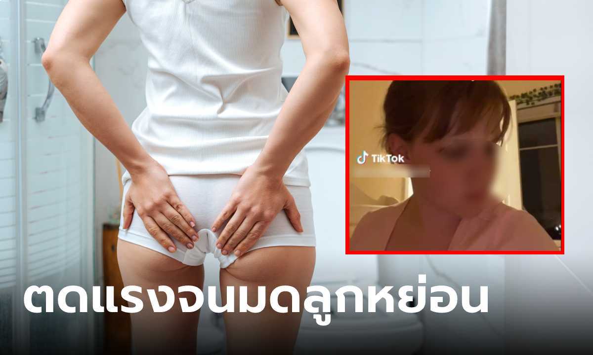 สาวแชร์ประสบการณ์ "ตดแรง" จนมดลูกหลุดออกจากช่องคลอด ไปหาแพทย์แนะนำแบบนี้