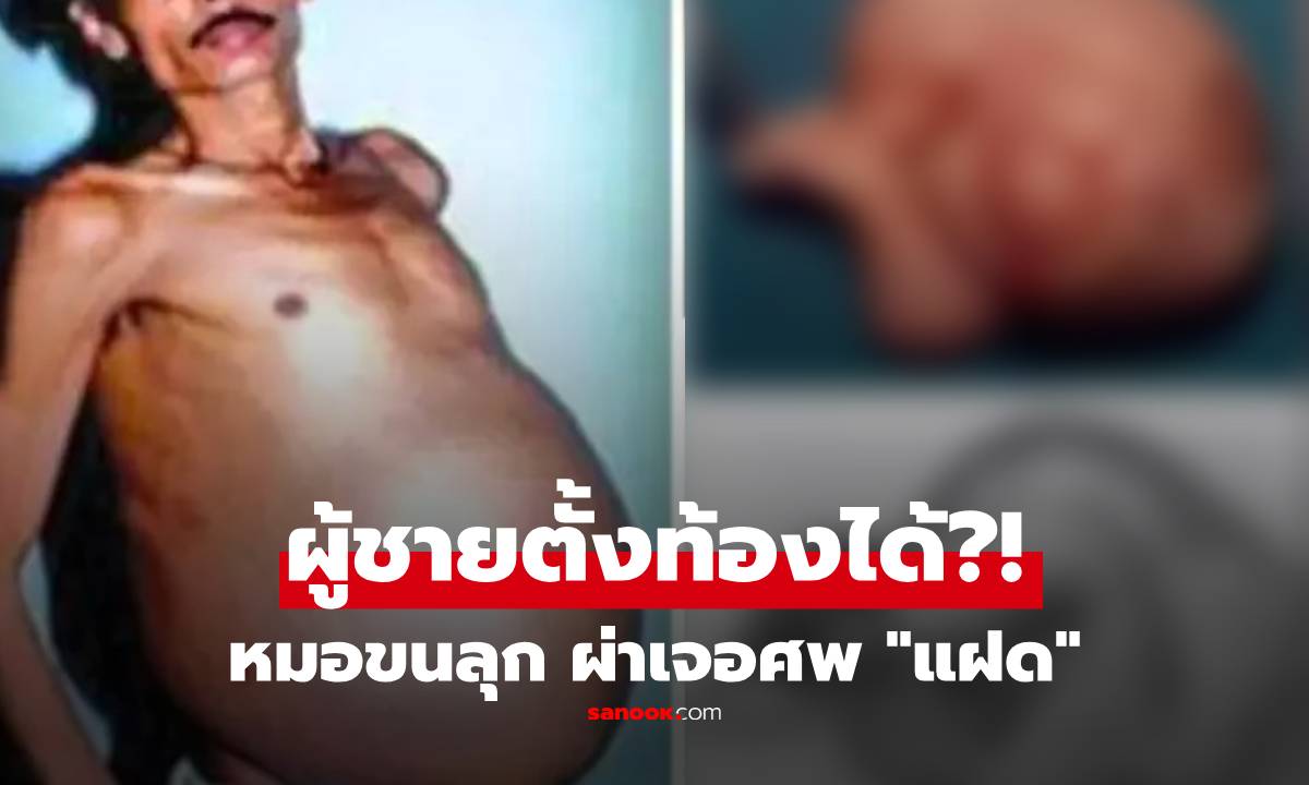 หมอขนลุก ผ่าท้องผู้ชายแท้ๆ เจอศพ 