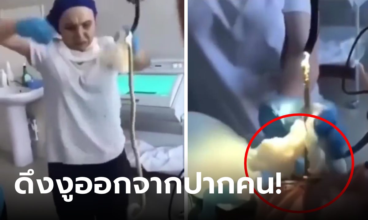 ยาวเป็นเมตร! หมอดึงงูออกจากปากคนไข้ พยาบาลตัวสั่นหน้าถอดสี รู้ว่าเข้าไปได้ไงยิ่งสยอง