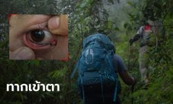 นักเดินป่าแทบช็อก หยิบกล้องขึ้นมาถ่ายรูป เจอทากไต่เข้าตาดูดเลือด แนะวิธีเอาตัวรอด