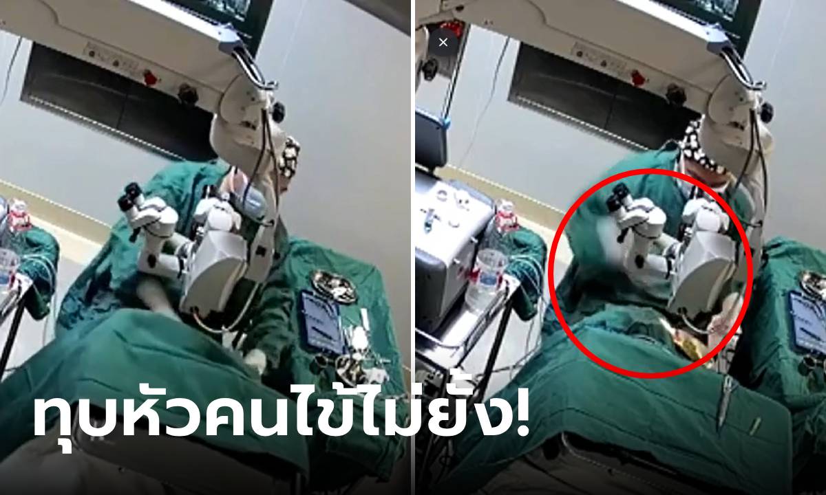 ช็อกมาก! แพทย์จีนทุบหัวคนไข้ สุดท้ายตาบอด รพ.อธิบายแล้ว เกิดอะไรขึ้นในห้องผ่าตัด?