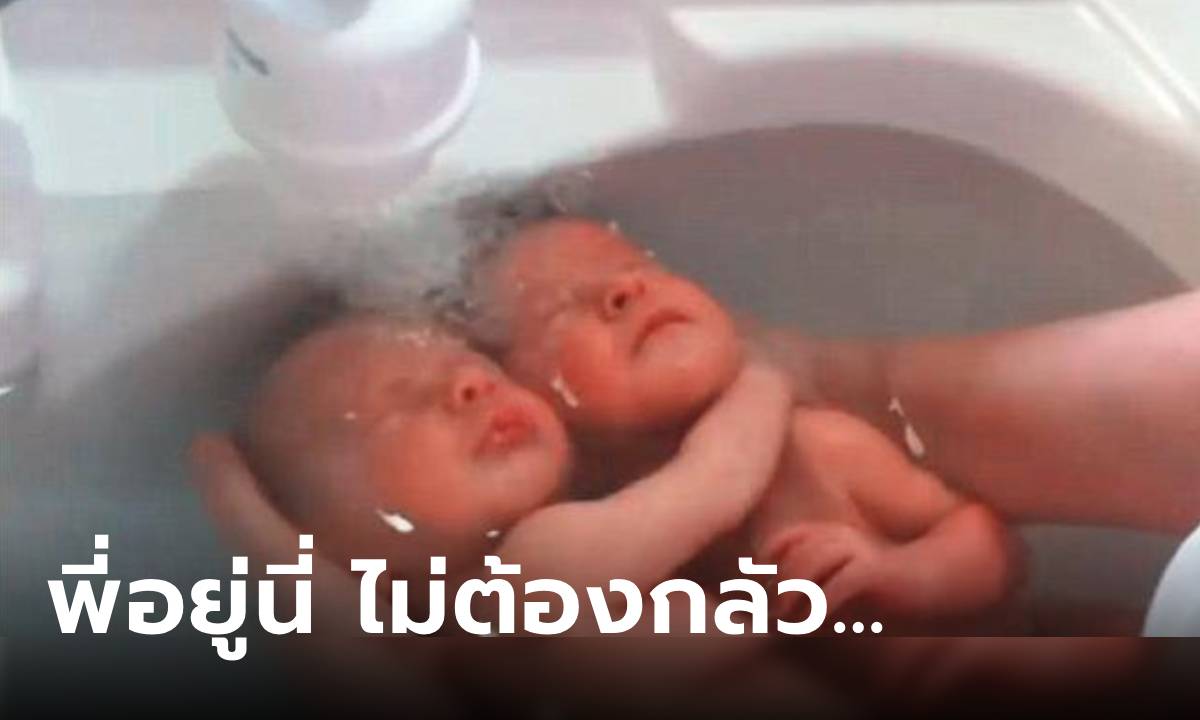 ทารกแฝดอาบน้ำครั้งแรก สัญชาตญาณ "พี่ชาย" ปกป้องน้องชาย ทำเอาพยาบาลยังทึ่ง!