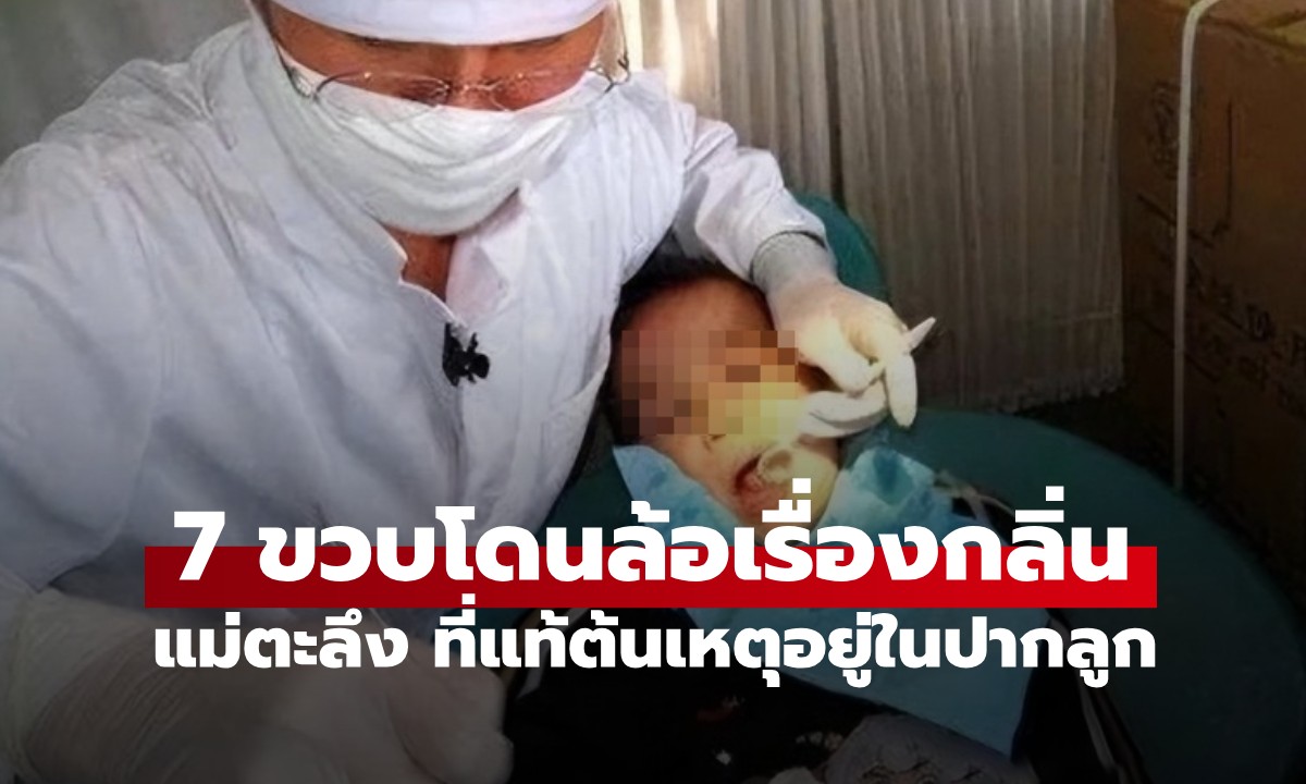 ลูกชาย 7 ขวบ ถูกเพื่อนล้อเพราะมีกลิ่น แม่ตะลึง เห็นสิ่งที่หมอหยิบออกจากปากลูก