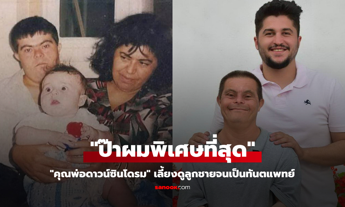 พลังแห่งรัก! สุดประทับใจ "คุณพ่อดาวน์ซินโดรม" เลี้ยงดูลูกชายจนได้เป็นทันตแพทย์