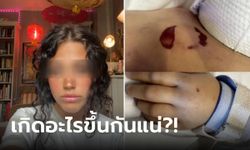 เป็นอะไรกันแน่?! นศ.หยุดหายใจ 23 นาที เล็บหลุด-แผลผุดเต็มตัว พ่อยังตามหาคำตอบ