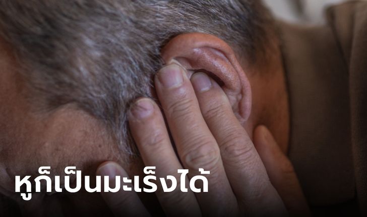 คนไข้แทบช็อก หมอบอกเป็นมะเร็งในช่องหู สาเหตุจากพฤติกรรมที่ทำทุกวันเป็น 10 ปี