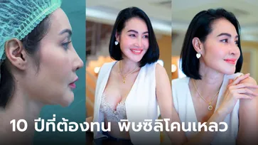 อึ้ง! "ษา วรรณาษา" ยกเครื่องใหม่หมด ทั้งหน้า-ทั้งนม ปิดฉาก 10 ปี พิษซิลิโคนเหลว