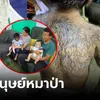 สาวคลอดลูกเป็น "มนุษย์หมาป่า" เชื่อโดนสาป เพราะกินแมวตอนท้อง หมอฟังแล้วรีบเบรก!