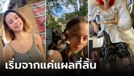 สาวอายุแค่ 24 เสียชีวิตหลังพบ "แผลที่ลิ้น" ที่แท้ป่วยโรคร้าย ทรมานจนร้องขอความตาย