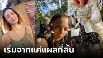 สาวอายุแค่ 24 เสียชีวิตหลังพบ "แผลที่ลิ้น" ที่แท้ป่วยโรคร้าย ทรมานจนร้องขอความตาย