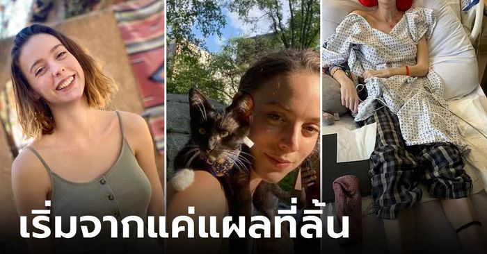 สาวอายุแค่ 24 เสียชีวิตหลังพบ "แผลที่ลิ้น" ที่แท้ป่วยโรคร้าย ทรมานจนร้องขอความตาย