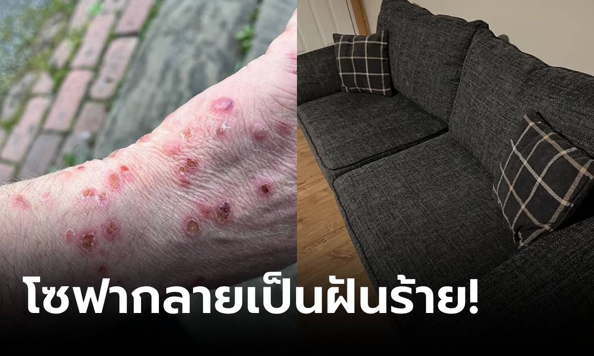 ซื้อไม่ใช่ถูกๆ โซฟาราคา 14,000 นั่งแล้วมี "รอยกัด" ยับเยินทั้งตัว ส่องดูข้างในถึงกับสยอง