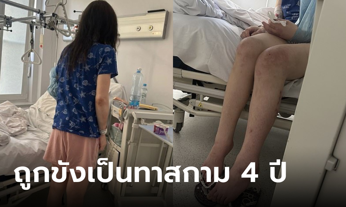 สาวถูก "คู่เดต" ขังเป็นทาสกาม 4 ปี ข่มขืนจนท้อง ทำร้ายทารุณฟันร่วง-ริมฝีปากหาย