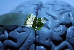 ครั้งแรก!!สหัฐฯพบวิธีตรวจสมอง หนทางรักษาอัลไซเมอร์