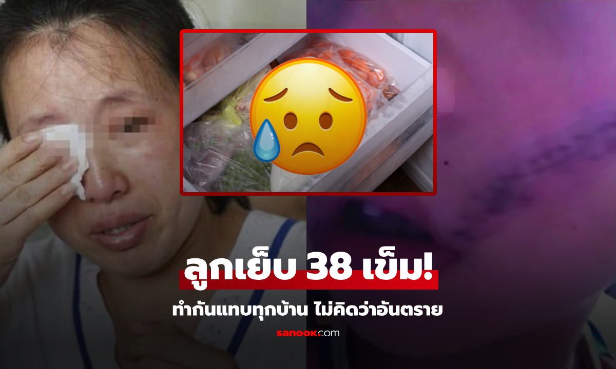 ลูกชายร้องลั่น เย็บหน้า 38 เข็ม แค่เพราะหยิบ "สิ่งนี้" จากช่องฟรีซ เตือนแช่ไว้แทบทุกบ้าน!!!