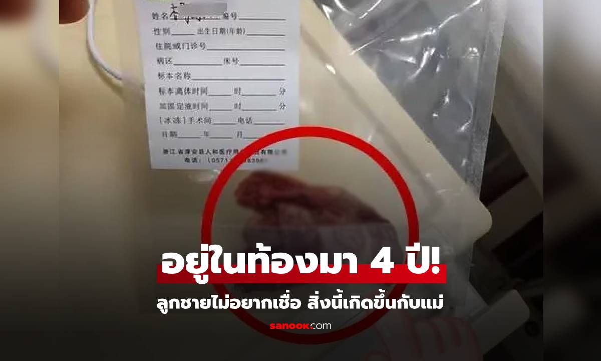 สะดุ้ง! เห็นสิ่งที่อยู่ในท้องแม่ สาเหตุปวดไม่หาย 4 ปี ลูกชายถามหมอ "ไหนความมืออาชีพ?!"