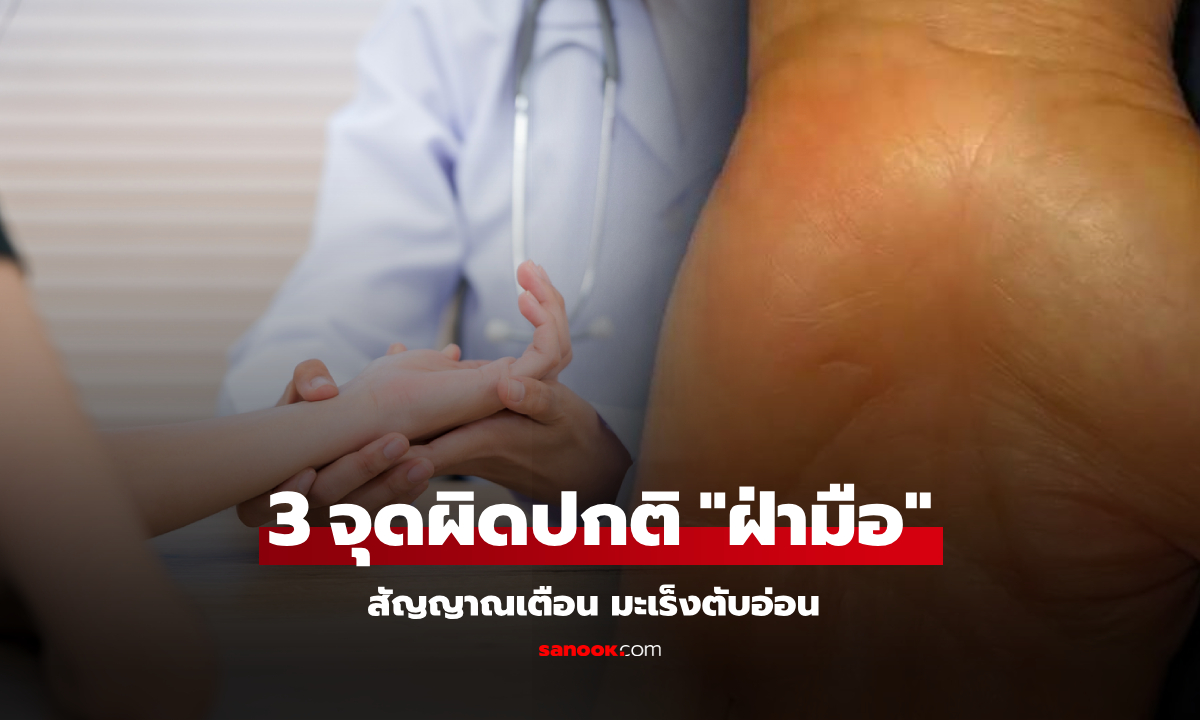 ใกล้ตัวมาก! ลองเช็กดู 3 จุดผิดปกติบน "ฝ่ามือ" เตือนมะเร็งตับอ่อน มองแวบแรกพลาดได้ง่ายๆ