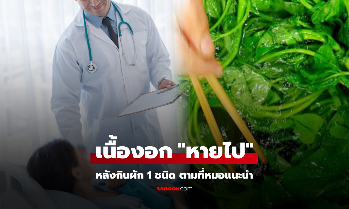 ได้ผล!!! หมอแนะคนไข้ กินผักชนิดนี้ 7 เดือน เนื้องอกในตับ "หายไป" อัลตราซาวนด์หาไม่เจอ