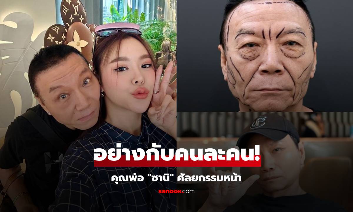 อย่างกับคนละคน! "ซานิ" เผยภาพคุณพ่อศัลยกรรมหน้าหล่อ อึ้ง! ดูเด็กลงมาก