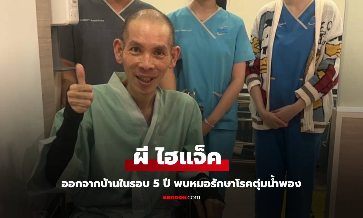 อัปเดตอาการ "ผี ไฮแจ็ค" ป่วยตุ่มน้ำพอง ออกจากบ้านพบหมอในรอบ 5 ปี