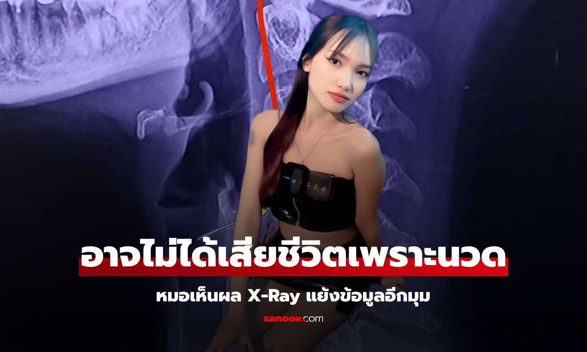 อ้าว ยังไง!? อาจารย์หมอเผย ผล X-Ray "ผิง ชญาดา" อาจไม่ได้เสียชีวิตเพราะนวด