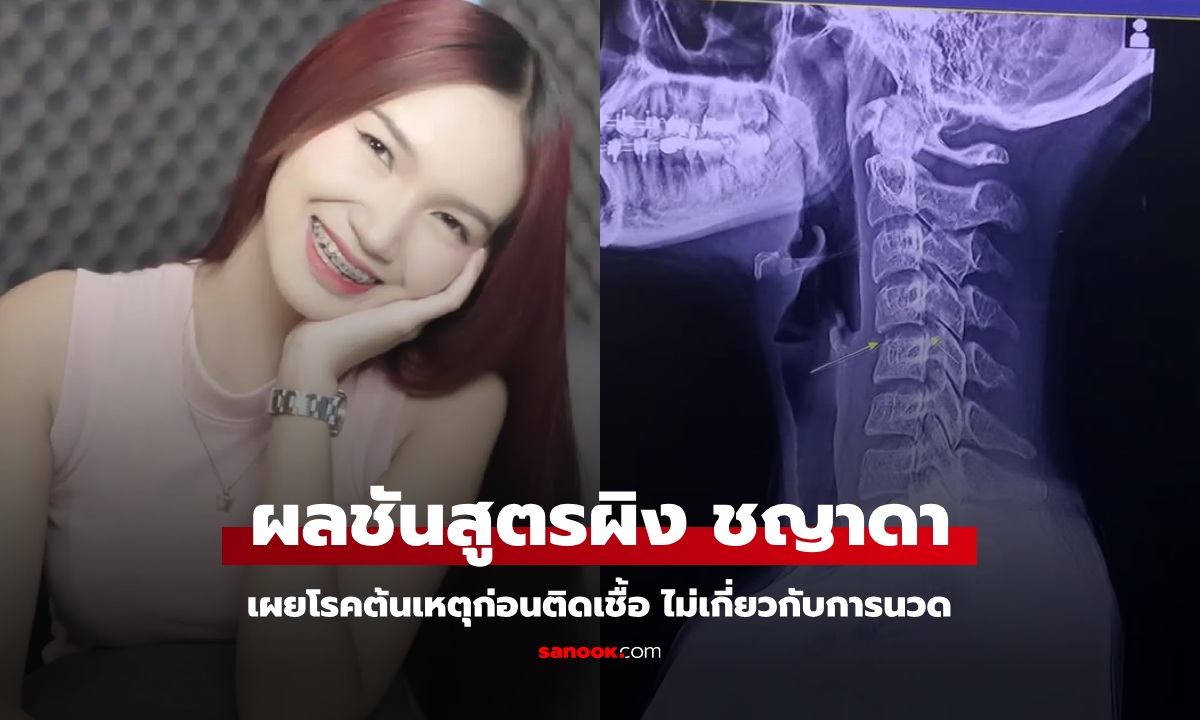 เปิดผลชันสูตร "ผิง ชญาดา" ป่วยโรคอะไร? ก่อนติดเชื้อในกระแสเลือด ไม่เกี่ยวกับนวด