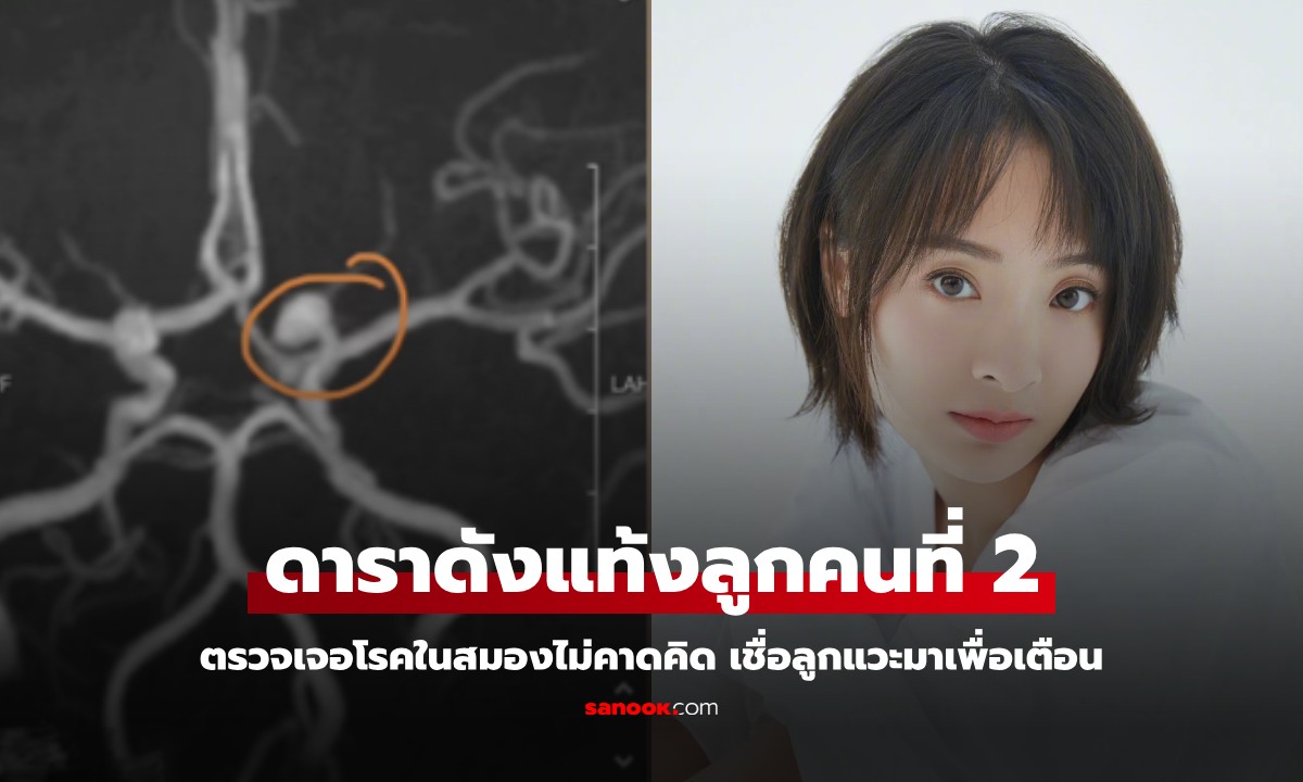 ดาราดังแท้งลูกคนที่ 2 ทำให้ตรวจเจอ "โรคในสมอง" ภัยเงียบที่ซ่อนอยู่ ขอบคุณที่ลูกแวะมาเตือน