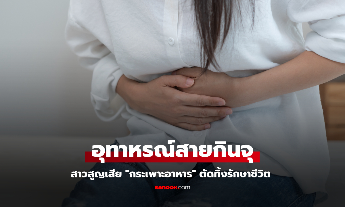 อุทาหรณ์สายกินจุ สาวสูญเสีย "กระเพาะอาหาร" ตัดทิ้งรักษาชีวิต สะพรึงกับสิ่งที่อยู่ในท้อง