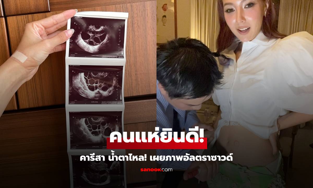 "คารีสา" น้ำตาไหล! เผยภาพอัลตราซาวด์ ทำคนแห่ยินดี