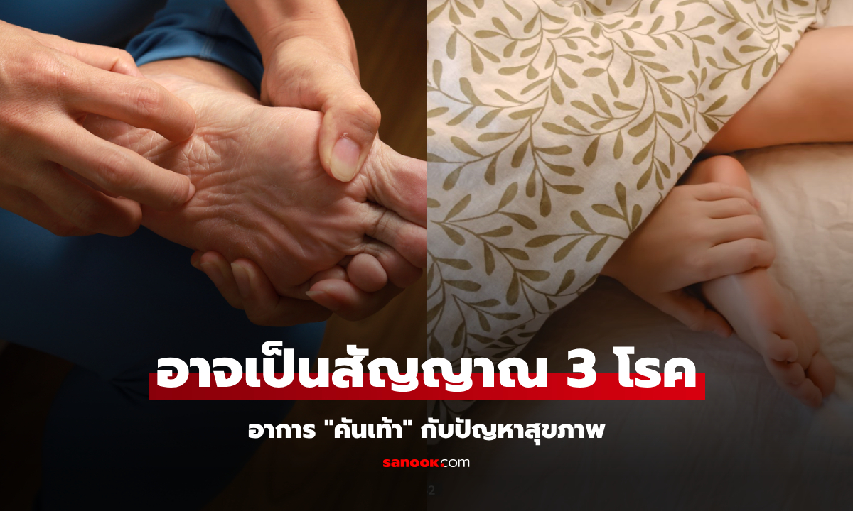 อาการ "คันเท้า" อาจเป็นสัญญาณ 3 ปัญหาสุขภาพร้ายแรง ไม่ใช่แค่เบาหวาน!