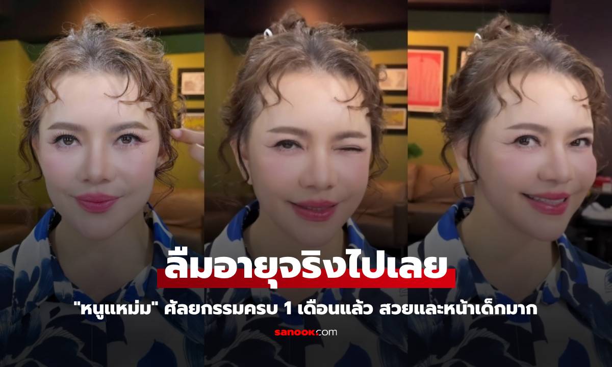 "หนูแหม่ม" ศัลยกรรมครบ 1 เดือนแล้ว สวยและหน้าเด็กมาก ลืมอายุจริงไปเลย