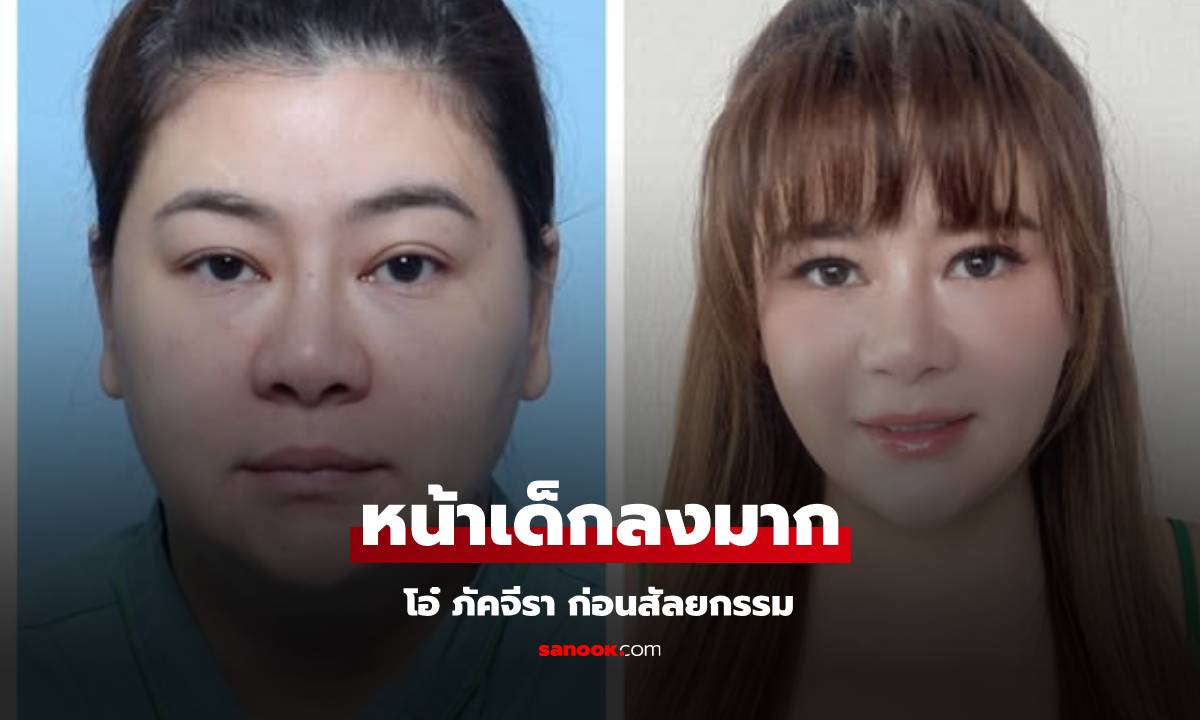 "โอ๋ ภัคจิรา" รีวิวแบบพลีชีพ เทียบภาพก่อนหลังศัลยกรรมในวัย 48