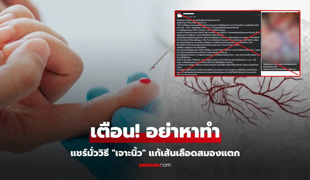 เตือนอย่าเชื่อ "เจาะนิ้ว" แก้เส้นเลือดสมองแตก ย้ำหากมี 5 อาการนี้ ต้องรีบส่ง รพ.ด่วน!