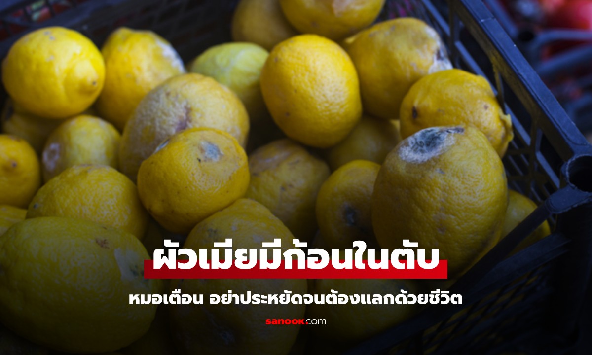 ผัวเมียมีก้อนเนื้อในตับ ทั้งที่ไม่ดื่ม-ไม่สูบ หมอเตือน อย่าประหยัดจนต้องแลกด้วยชีวิต