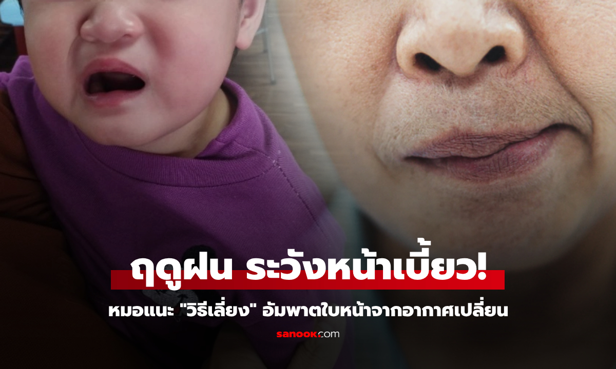 หมอเตือนด่วน! ฝนตกลมแรง หลายคนตื่นมา "หน้าเบี้ยว" หนุ่มสาวสุขภาพดียังไม่รอด