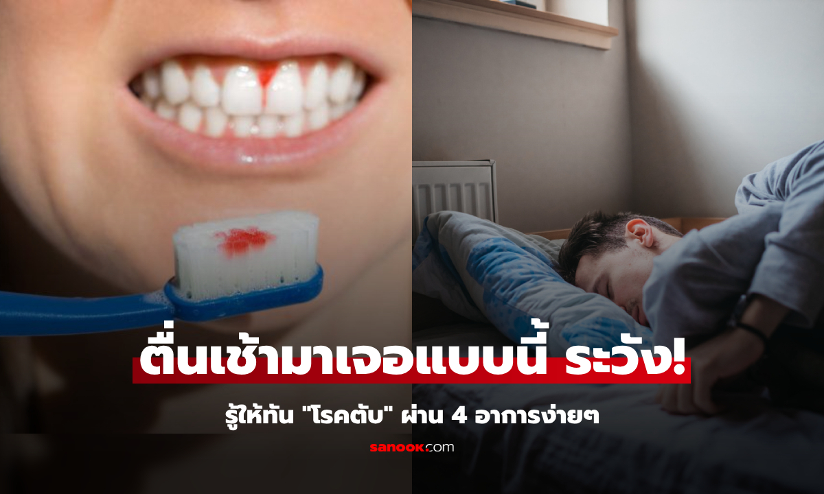 รู้ให้ทันก่อนสาย 4 อาการตอนเช้า อาจเป็นสัญญาณ "โรคตับ" ไม่ใช่เรื่องเล็ก ควรรีบพบแพทย์!