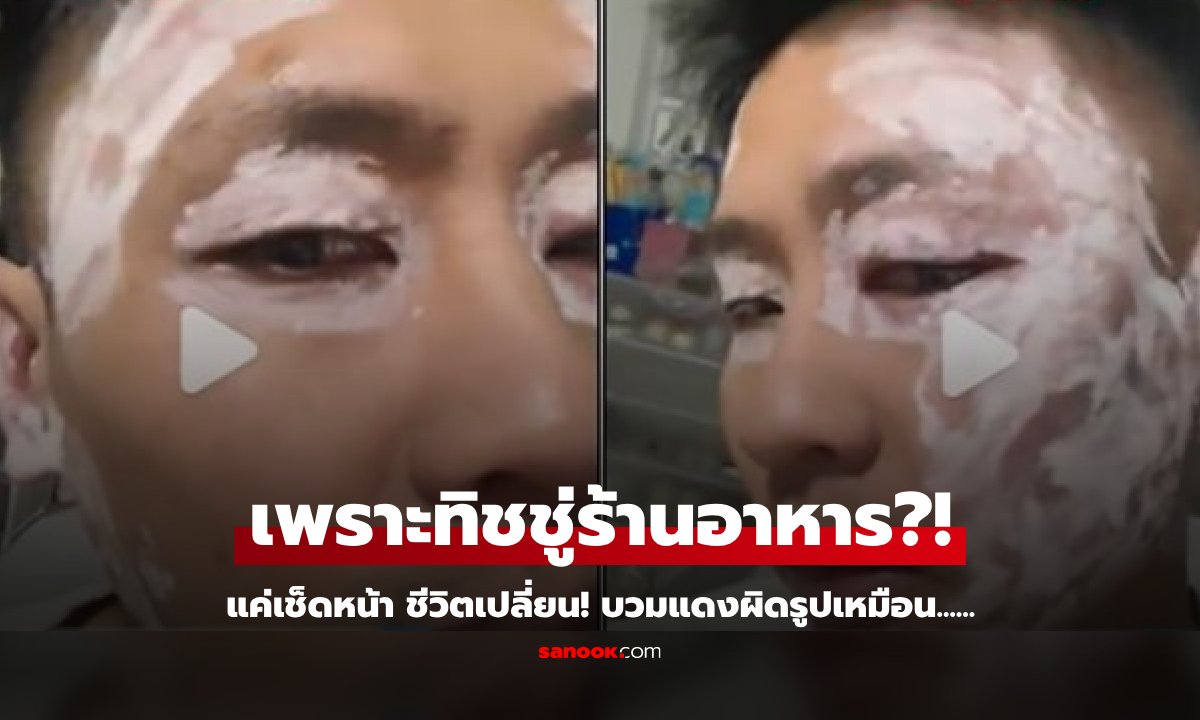 สภาพสะพรึง! หนุ่มเซลฟี่พลีชีพ เตือน "เช็ดหน้า" ด้วยทิชชู่ร้านอาหาร บวมแดงเหมือน "สิ่งนั้น"
