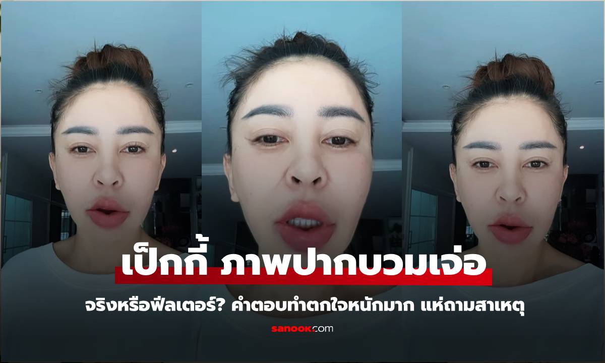 "เป๊กกี้" ลงภาพปากบวมเจ่อ แห่ถามของจริงหรือฟีลเตอร์ ฟังคำตอบแล้วตกใจ เผยสาเหตุยิ่งตกใจกว่า