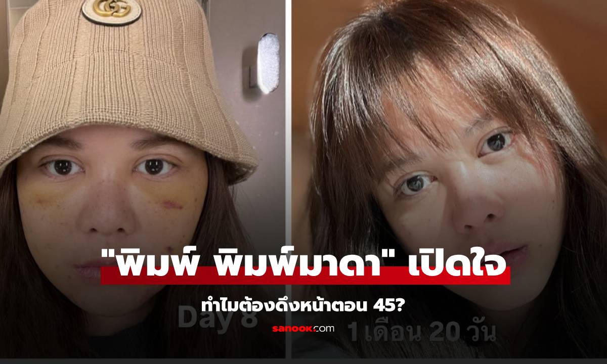 ถอดรหัสความสวยเป๊ะ! "พิมพ์ พิมพ์มาดา" เปิดใจทำไมต้องดึงหน้าตอน 45?