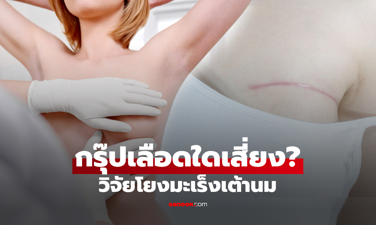 นักวิทย์ฯ พบ "กรุ๊ปเลือดหนึ่ง" มีปัจจัยเสี่ยงมะเร็งเต้านม มากขึ้นถึง 18% เมื่อเทียบกับกรุ๊ป O